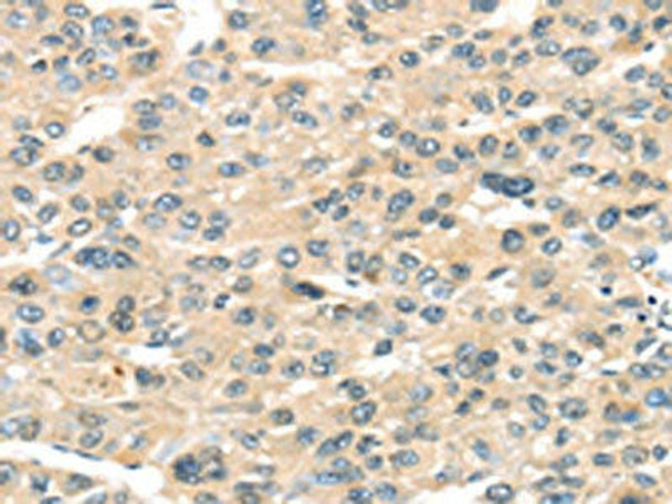 HAUS7 Antibody (PACO20813)