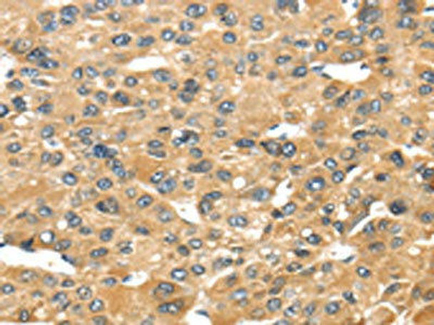 UCP1 Antibody (PACO20815)