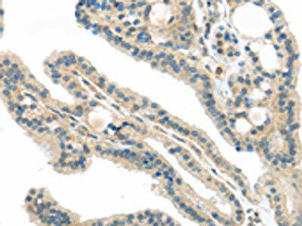 VPS26A Antibody (PACO20864)