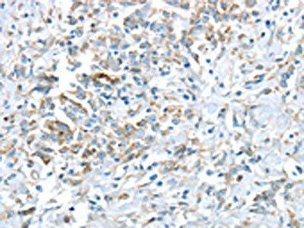 VWCE Antibody (PACO20868)