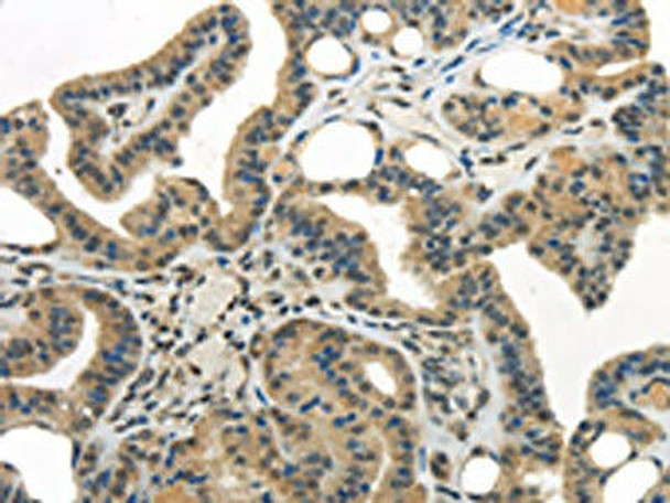 WDR36 Antibody (PACO20877)