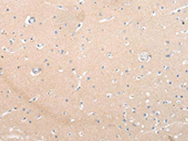 ZNF106 Antibody (PACO20966)