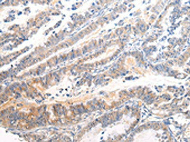 APLN Antibody (PACO20971)
