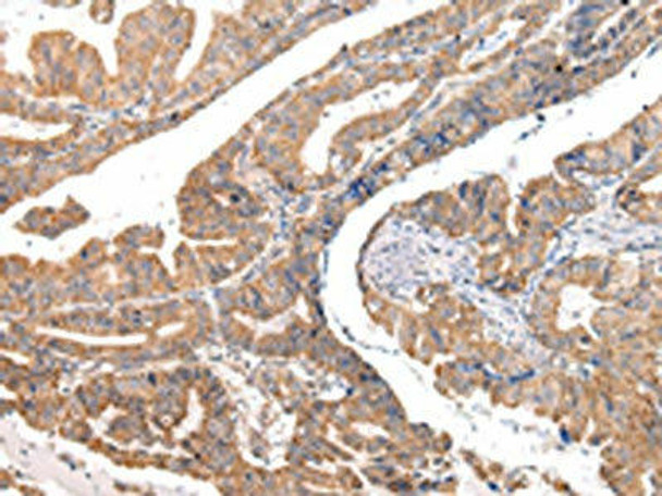 COL8A2 Antibody (PACO20975)