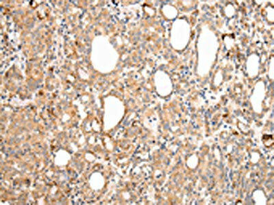 AXIN1 Antibody (PACO20994)