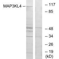MLK4 Antibody (PACO21877)