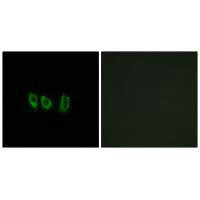 CSTL1 Antibody (PACO22294)