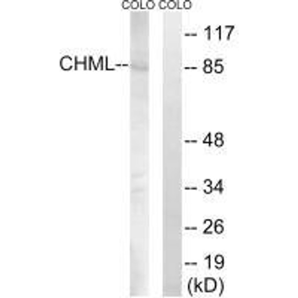 CHML Antibody (PACO23470)
