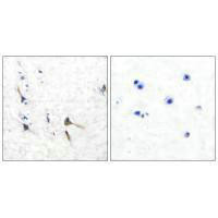 KCNC2 Antibody (PACO23694)