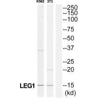 LAMC3 Antibody (PACO23788)