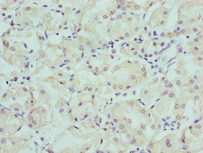 CFAP410 Antibody (PACO25352)