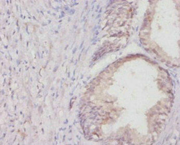 Col1a1 Antibody (PACO25857)