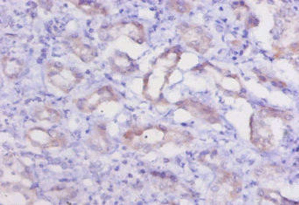Ctsk Antibody (PACO26033)