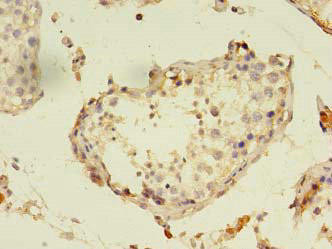 PANK1 Antibody (PACO28798)