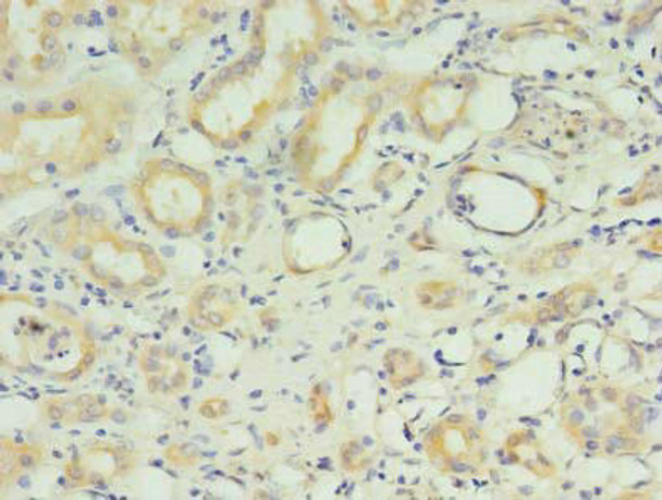 RNF183 Antibody (PACO29552)