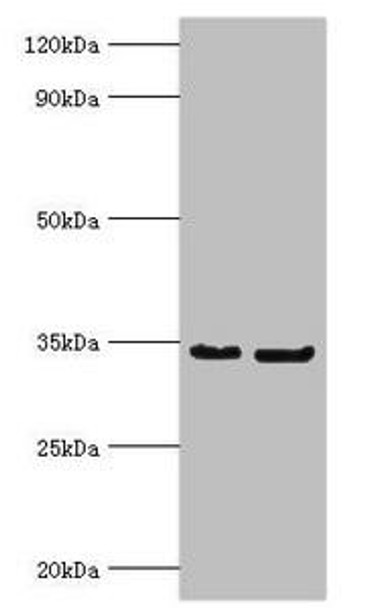 P Antibody (PACO34008)