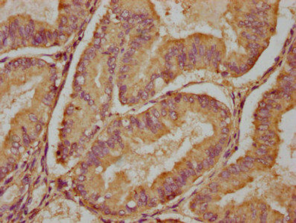 PDE6H Antibody (PACO35442)