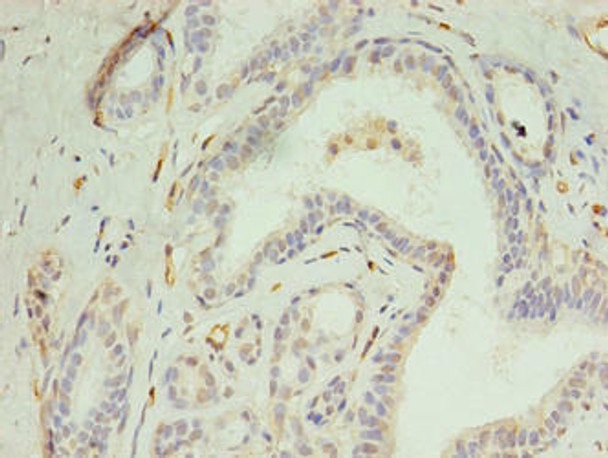 DIP2A Antibody (PACO35770)