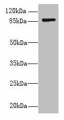 FSCB Antibody (PACO36266)