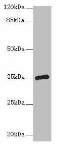 CPXCR1 Antibody (PACO38218)