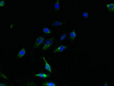 TMEM159 Antibody (PACO39550)