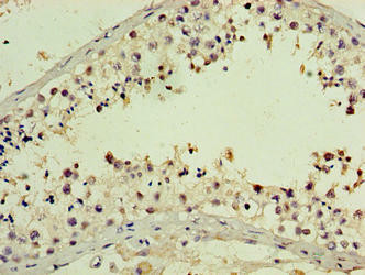 PNMA5 Antibody (PACO39882)