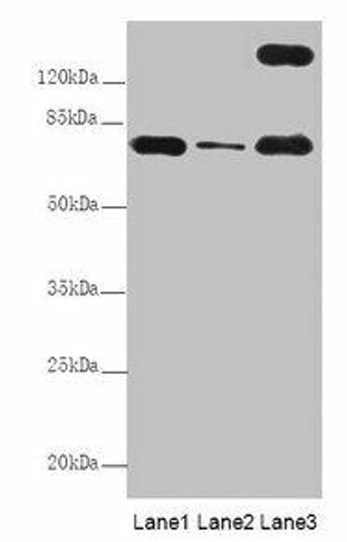 TTC12 Antibody (PACO40426)