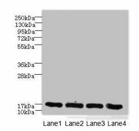 PLGRKT Antibody (PACO41358)