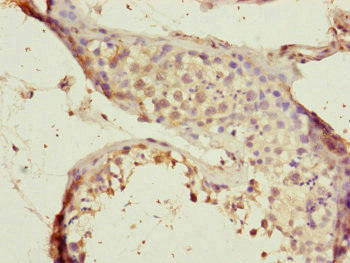 CEP72 Antibody (PACO45064)