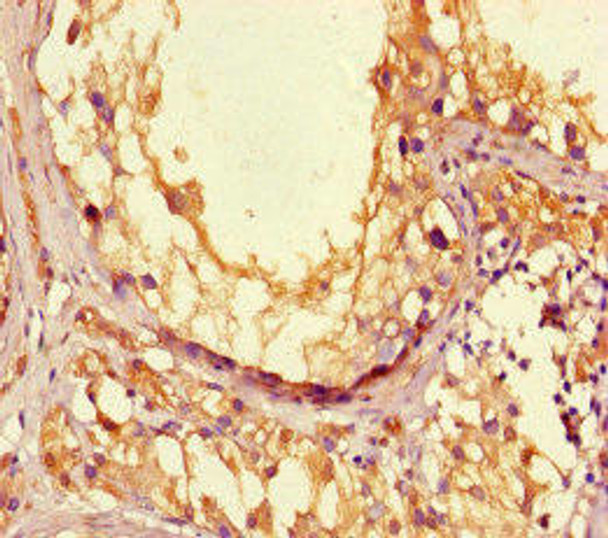 LPAL2 Antibody (PACO46518)