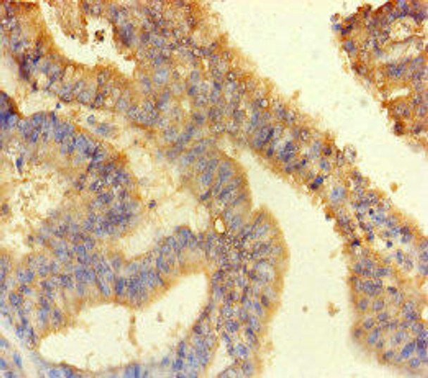 ANKS6 Antibody (PACO46594)