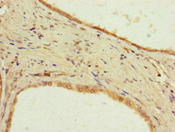 PPP2R2D Antibody (PACO46614)