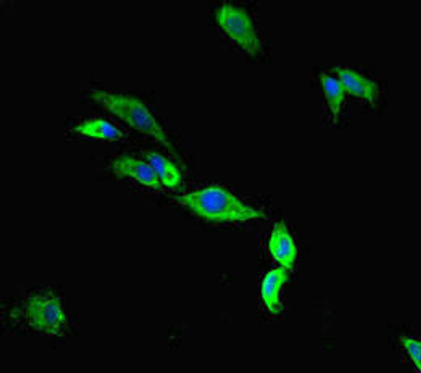 TMC2 Antibody (PACO46998)