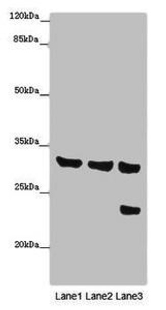 SLC25A10 Antibody (PACO47162)