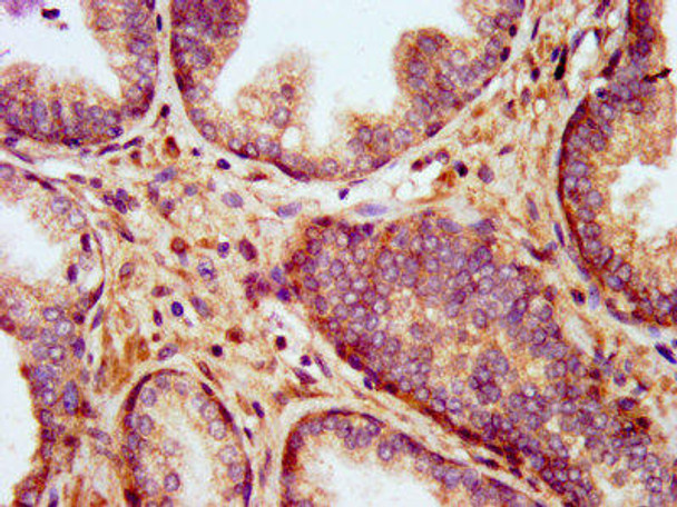 KCNT1 Antibody (PACO57176)