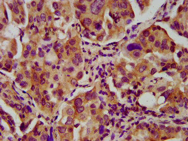 NEB Antibody (PACO58084)