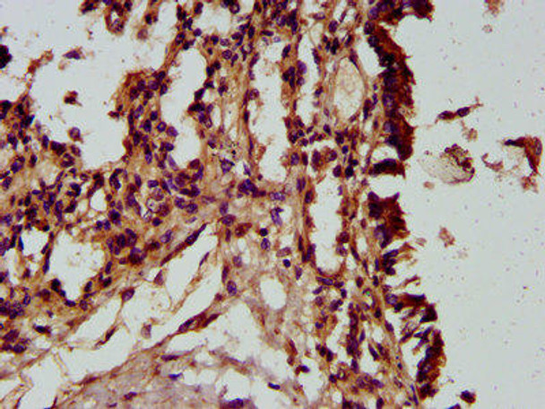 HECTD2 Antibody (PACO58188)