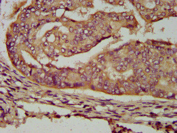 ENOSF1 Antibody (PACO58204)