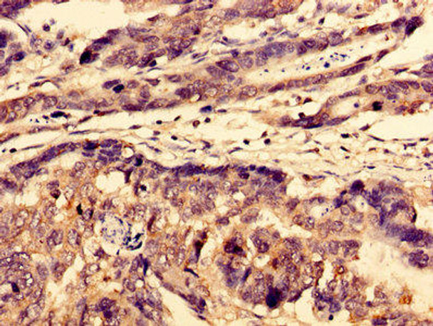 WDFY3 Antibody (PACO58260)