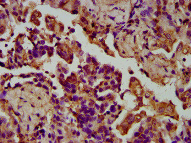 LGI4 Antibody (PACO58288)