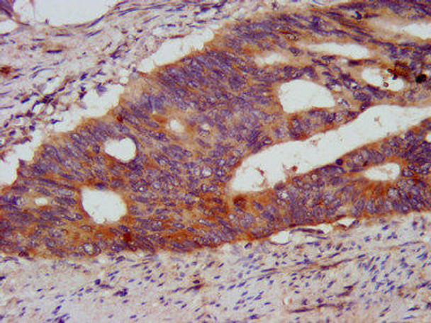 KCMF1 Antibody (PACO58524)