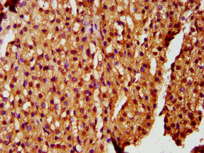 ZKSCAN5 Antibody (PACO58608)