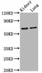 SRRM4 Antibody (PACO58805)