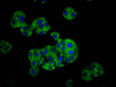 CYP26C1 Antibody (PACO59149)