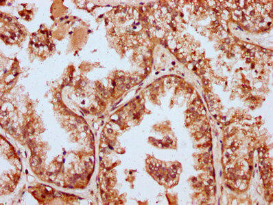 MBNL3 Antibody (PACO59389)