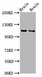CLIP2 Antibody (PACO59397)