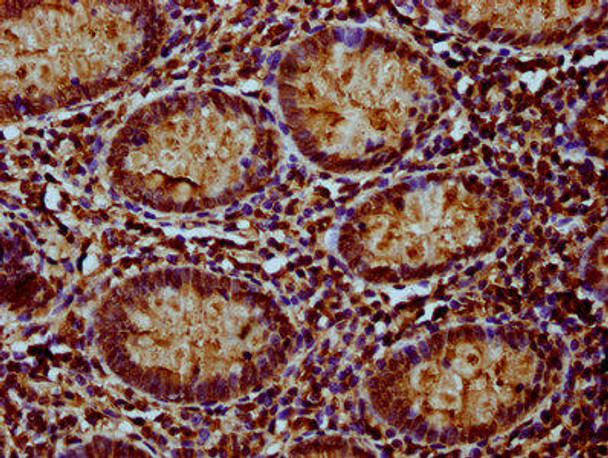 NDUFAF3 Antibody (PACO59437)