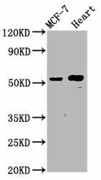 NOP53 Antibody (PACO59493)