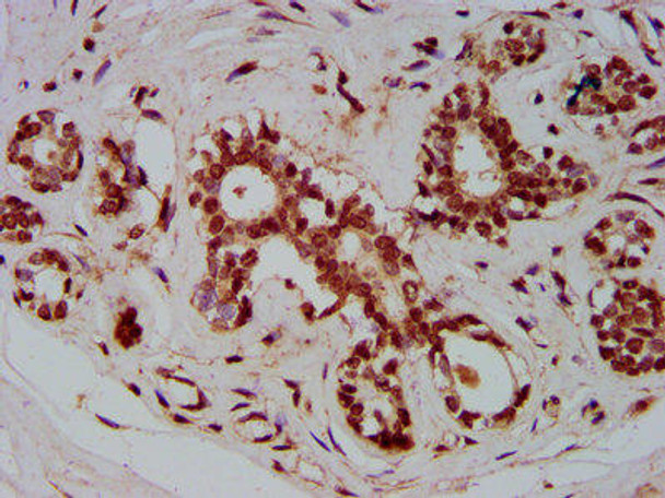 ZMIZ1 Antibody (PACO59533)