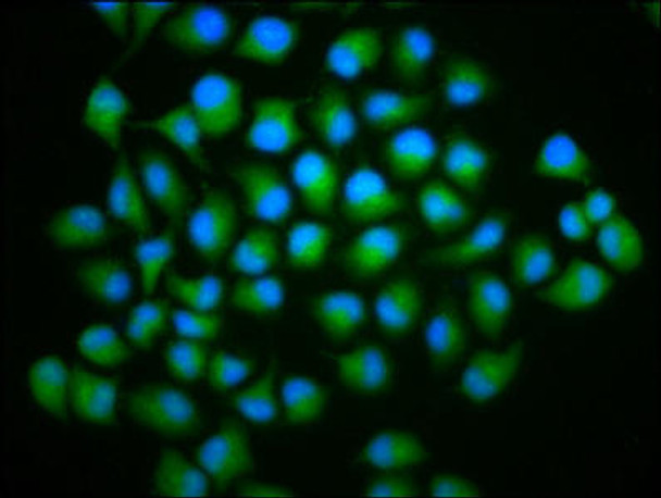 TYW5 Antibody (PACO59684)